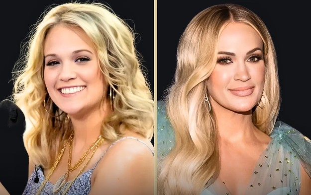 Did Carrie Underwood Have Plastic Surgery