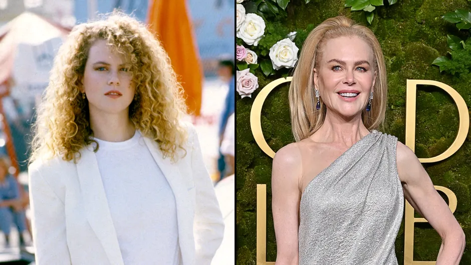 nicole kidman before and after